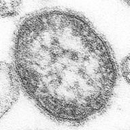 measles outbreak: read more at bbc.co.uk