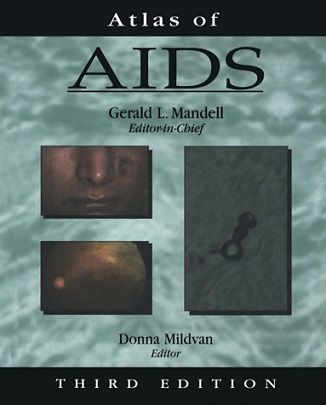 atlas-of-aids-3rd-edition-1-638_zpsyfbwu